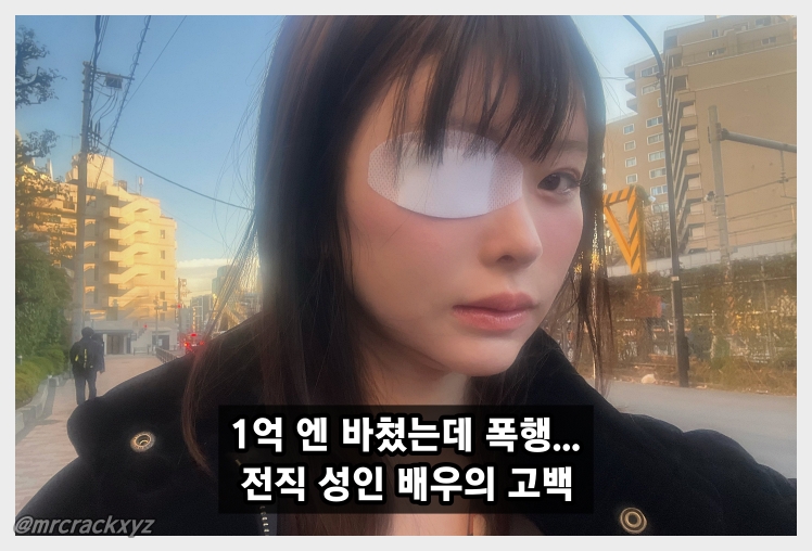 '아스미 미라이' 마츠모토 레이라, 전남친에게 폭행당해.. 피의자는 약 1억엔을 쏟아부었던 호스트