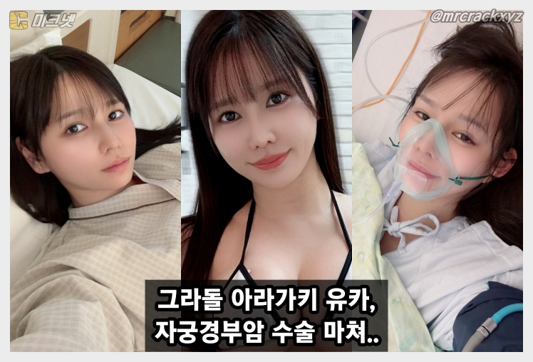 아라가키 유카, 자궁경부암 전단계 수술 후 초고속 퇴원... 