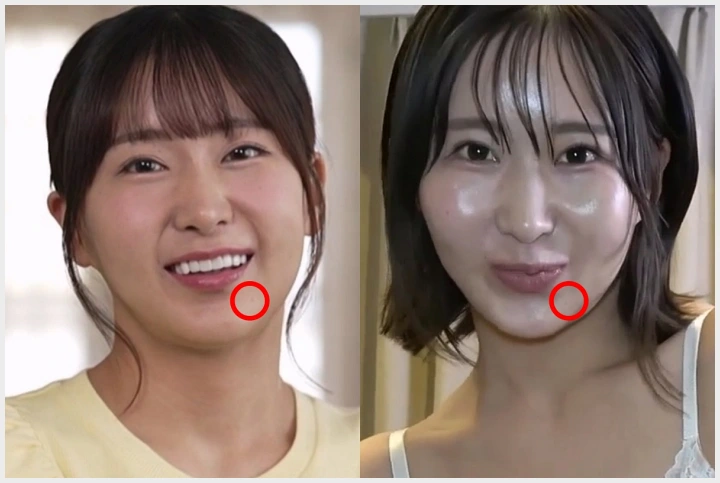 유이 히나, 무수정 동인 AV 유출 의혹! 증거는 \'턱에 있는 점\' - 1