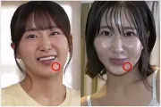 유이 히나, 무수정 동인 AV 유출 의혹! 증거는 '턱에 있는 점'
