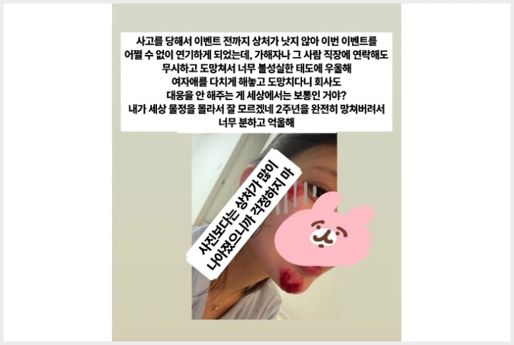 쿠라키 하나, 교통사고로 안면 부상 및 활동 중단 "가해자 측 연락 없어.." - 2
