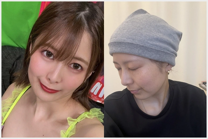 토요오카 사츠키, 항암 치료 중단…"내 몸의 한계, 나답게 살아가겠다" - 1 토요오카 사츠키, 항암 치료 중단…"내 몸의 한계, 나답게 살아가겠다" - 1