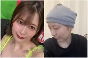 토요오카 사츠키, 항암 치료 중단…내 몸의 한계, 나답게 살아가겠다
